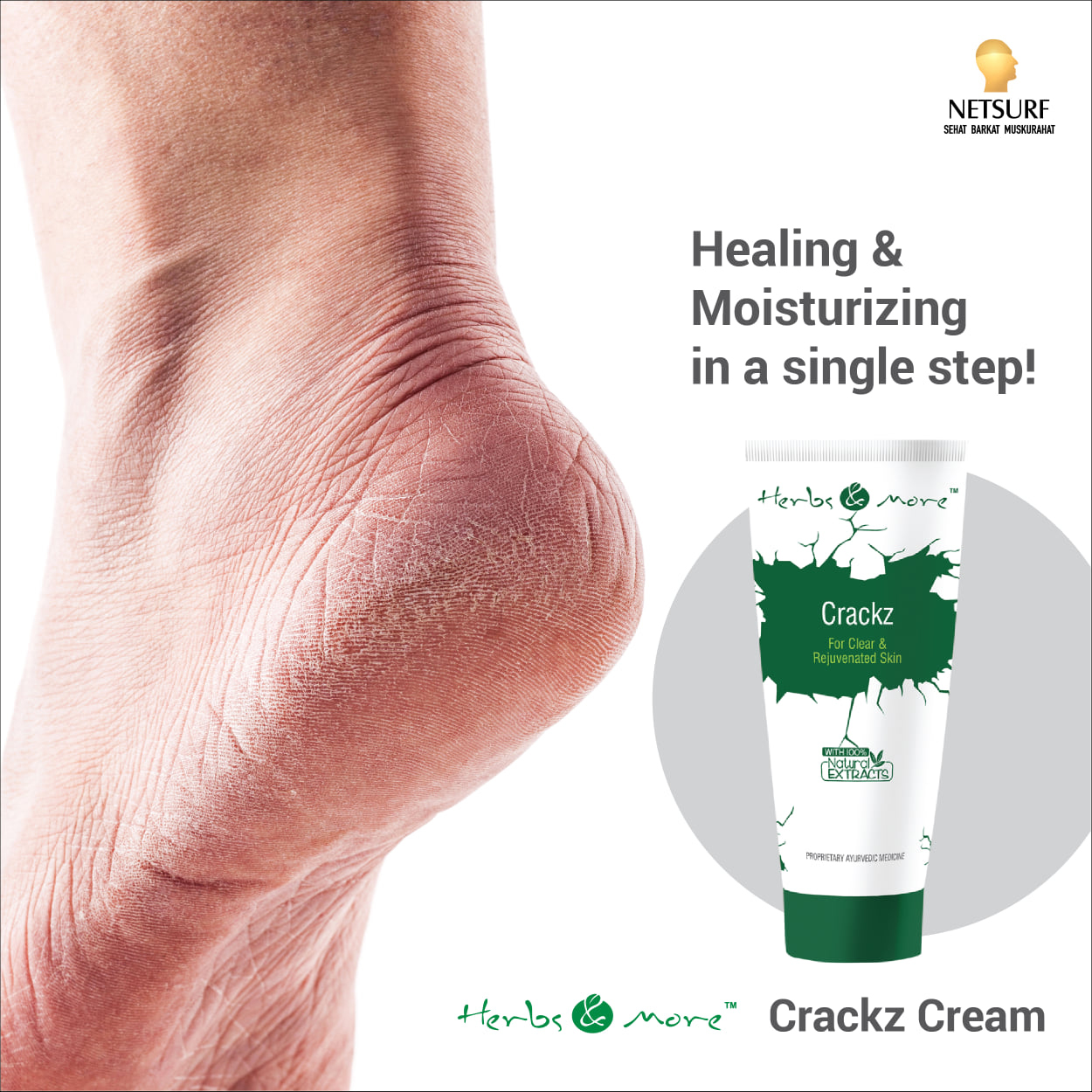 Mellow Herbals: Crack Heal Cream With Sesame and Castor Oil For Rough And...